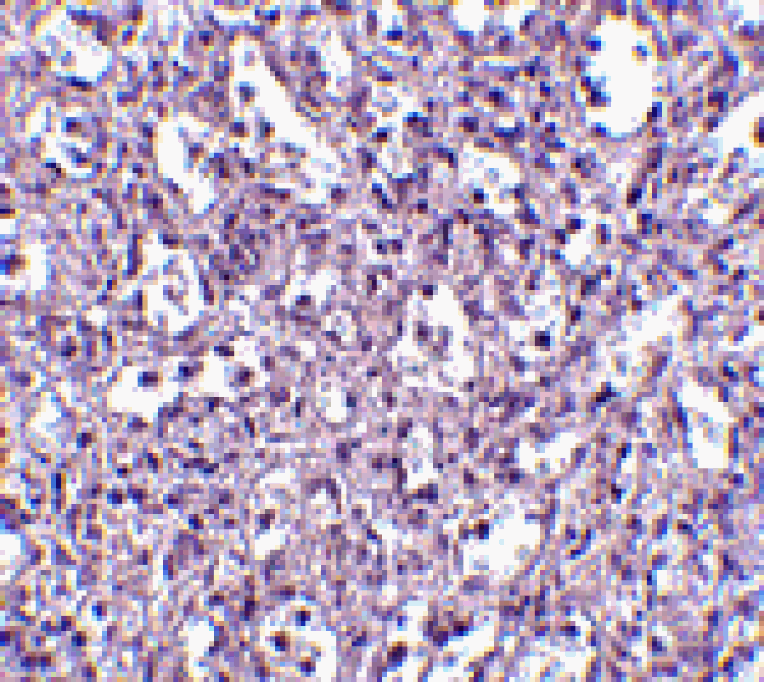 Immunohistochemistry - Carabin Antibody from Signalway Antibody (24548) - Antibodies.com