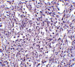 Immunohistochemistry - Carabin Antibody from Signalway Antibody (24548) - Antibodies.com