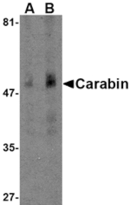Western blot - Carabin Antibody from Signalway Antibody (24549) - Antibodies.com