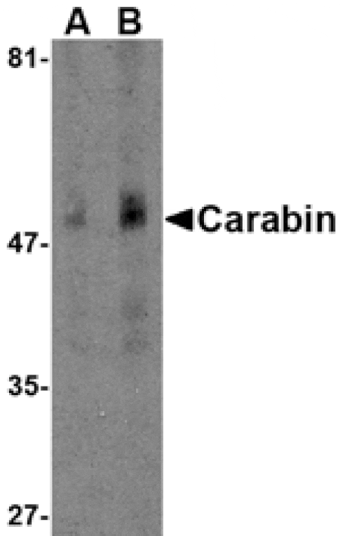 Western blot - Carabin Antibody from Signalway Antibody (24549) - Antibodies.com