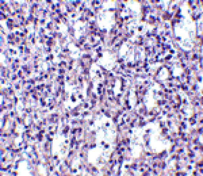 Immunohistochemistry - Carabin Antibody from Signalway Antibody (24549) - Antibodies.com