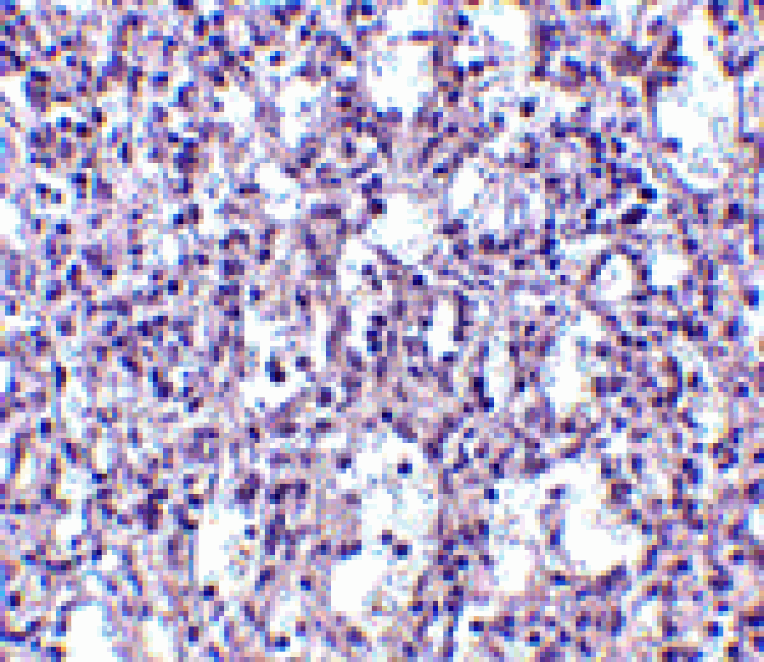 Immunohistochemistry - Carabin Antibody from Signalway Antibody (24549) - Antibodies.com