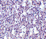 Immunohistochemistry - Carabin Antibody from Signalway Antibody (24549) - Antibodies.com