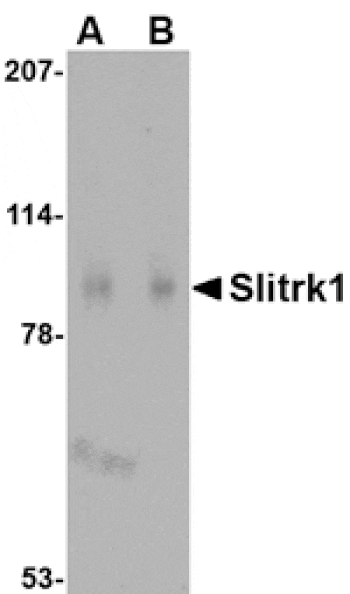 Western blot - Slitrk1 Antibody from Signalway Antibody (24627) - Antibodies.com