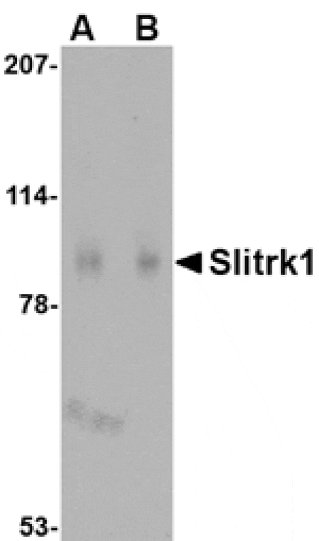 Western blot - Slitrk1 Antibody from Signalway Antibody (24627) - Antibodies.com