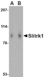 Western blot - Slitrk1 Antibody from Signalway Antibody (24628) - Antibodies.com