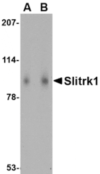 Western blot - Slitrk1 Antibody from Signalway Antibody (24628) - Antibodies.com