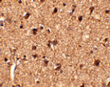 Immunohistochemistry - Slitrk1 Antibody from Signalway Antibody (24628) - Antibodies.com