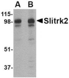Western blot - Slitrk2 Antibody from Signalway Antibody (24629) - Antibodies.com