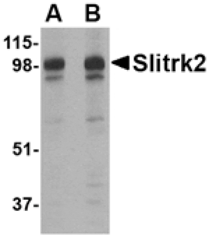 Western blot - Slitrk2 Antibody from Signalway Antibody (24629) - Antibodies.com