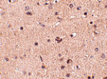 Immunohistochemistry - Slitrk2 Antibody from Signalway Antibody (24629) - Antibodies.com