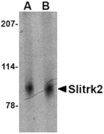 Western blot - Slitrk2 Antibody from Signalway Antibody (24630) - Antibodies.com