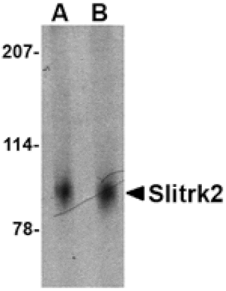 Western blot - Slitrk2 Antibody from Signalway Antibody (24630) - Antibodies.com