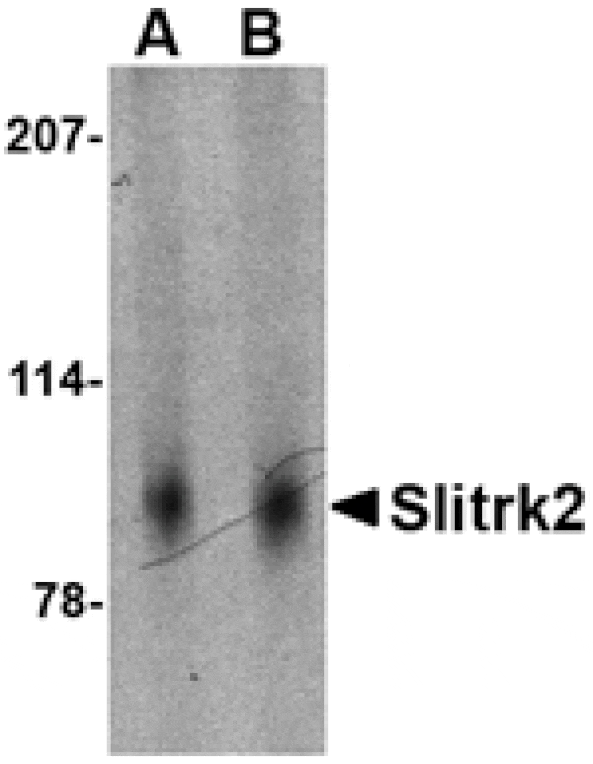 Western blot - Slitrk2 Antibody from Signalway Antibody (24630) - Antibodies.com