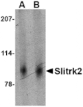 Western blot - Slitrk2 Antibody from Signalway Antibody (24630) - Antibodies.com