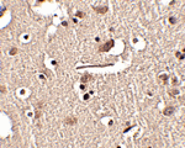 Immunohistochemistry - Slitrk2 Antibody from Signalway Antibody (24630) - Antibodies.com