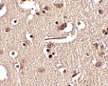 Immunohistochemistry - Slitrk2 Antibody from Signalway Antibody (24630) - Antibodies.com