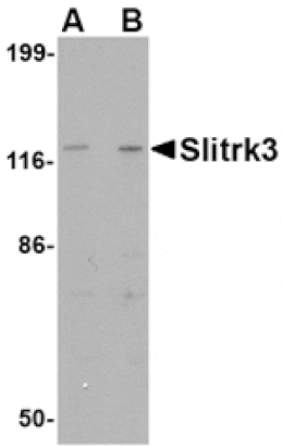 Western blot - Slitrk3 Antibody from Signalway Antibody (24631) - Antibodies.com