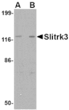 Western blot - Slitrk3 Antibody from Signalway Antibody (24631) - Antibodies.com