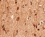 Immunohistochemistry - Slitrk3 Antibody from Signalway Antibody (24631) - Antibodies.com