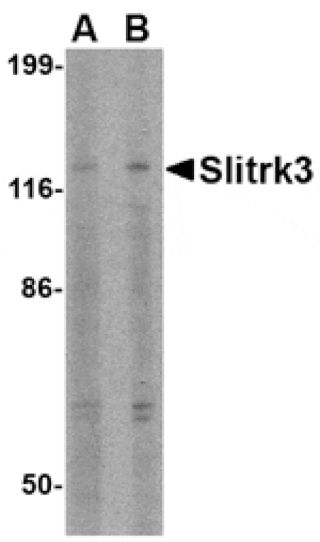 Western blot - Slitrk3 Antibody from Signalway Antibody (24632) - Antibodies.com