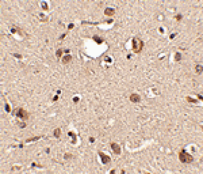 Immunohistochemistry - Slitrk3 Antibody from Signalway Antibody (24632) - Antibodies.com