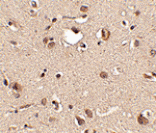 Immunohistochemistry - Slitrk3 Antibody from Signalway Antibody (24632) - Antibodies.com