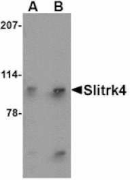 Western blot - Slitrk4 Antibody from Signalway Antibody (24634) - Antibodies.com
