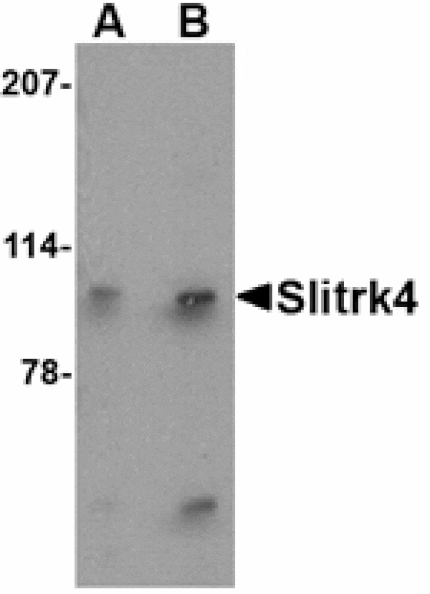 Western blot - Slitrk4 Antibody from Signalway Antibody (24634) - Antibodies.com