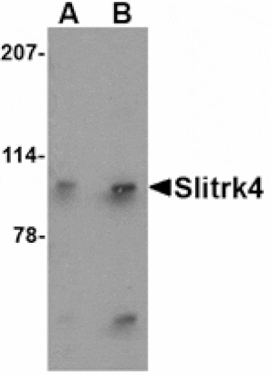 Western blot - Slitrk4 Antibody from Signalway Antibody (24634) - Antibodies.com