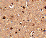 Immunohistochemistry - Slitrk4 Antibody from Signalway Antibody (24634) - Antibodies.com