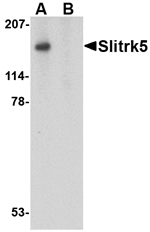 Western blot analysis of Slitrk4 in mouse brain tissue lysate with Slitrk4 antibody at (A) 0.5 and (B) 1 µg/mL.