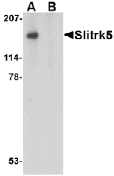 Western blot - Slitrk5 Antibody from Signalway Antibody (24635) - Antibodies.com