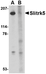 Western blot analysis of Slitrk5 in 3T3 cell lysate with Slitrk5 antibody at 1 µg/mL in the (A) absence or (B) presence of blocking peptide.
