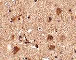 Immunohistochemistry - Slitrk5 Antibody from Signalway Antibody (24636) - Antibodies.com