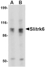Western blot - Slitrk6 Antibody from Signalway Antibody (24637) - Antibodies.com