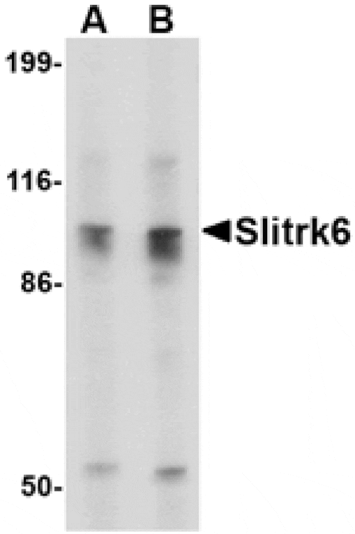 Western blot - Slitrk6 Antibody from Signalway Antibody (24637) - Antibodies.com
