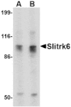 Western blot - Slitrk6 Antibody from Signalway Antibody (24637) - Antibodies.com