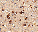 Immunohistochemistry - Slitrk6 Antibody from Signalway Antibody (24637) - Antibodies.com