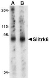 Western blot - Slitrk6 Antibody from Signalway Antibody (24638) - Antibodies.com