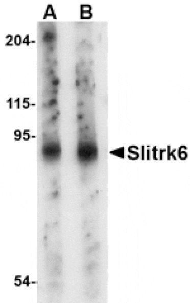 Western blot - Slitrk6 Antibody from Signalway Antibody (24638) - Antibodies.com