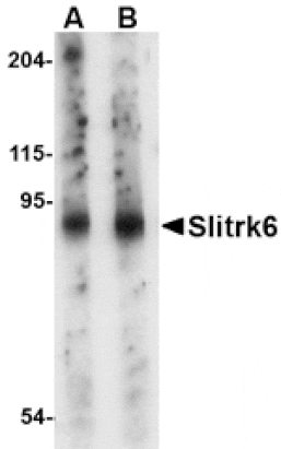 Western blot - Slitrk6 Antibody from Signalway Antibody (24638) - Antibodies.com