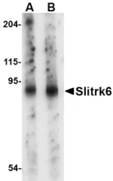 Western blot - Slitrk6 Antibody from Signalway Antibody (24638) - Antibodies.com