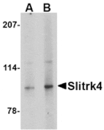 Western blot - Slitrk4 Antibody from Signalway Antibody (24639) - Antibodies.com