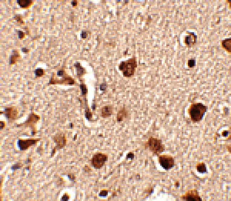 Immunohistochemistry - Slitrk4 Antibody from Signalway Antibody (24639) - Antibodies.com