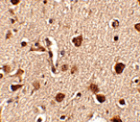 Immunohistochemistry - Slitrk4 Antibody from Signalway Antibody (24639) - Antibodies.com