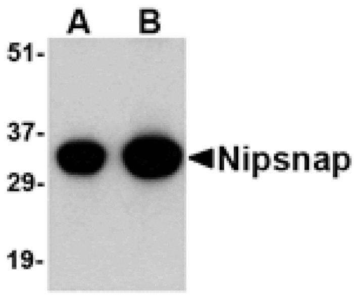Western blot - NIPSNAP Antibody from Signalway Antibody (24656) - Antibodies.com