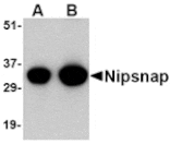 Western blot - NIPSNAP Antibody from Signalway Antibody (24656) - Antibodies.com
