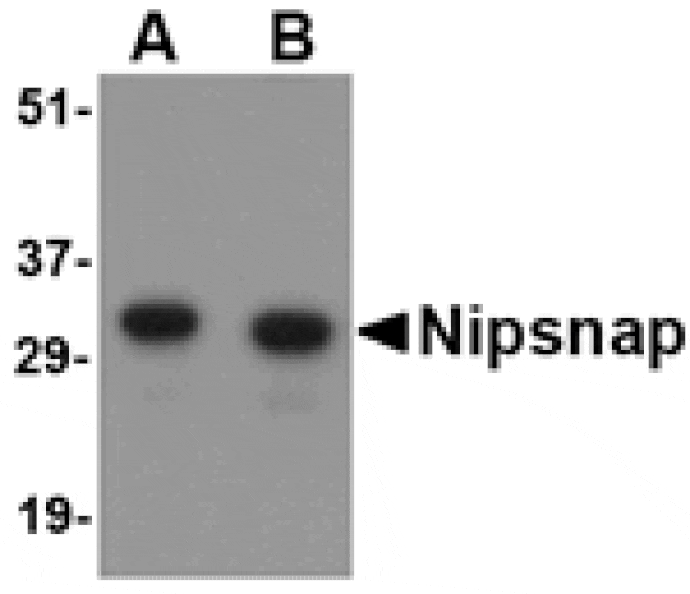 Western blot - NIPSNAP Antibody from Signalway Antibody (24657) - Antibodies.com