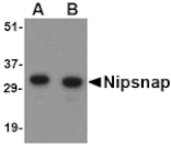 Western blot - NIPSNAP Antibody from Signalway Antibody (24657) - Antibodies.com